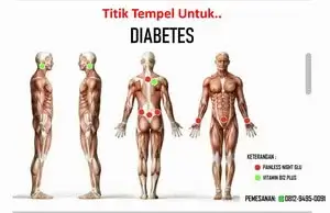 Titik-tempel-untuk-kesembuhan-penyakit-diabetes One MOre International