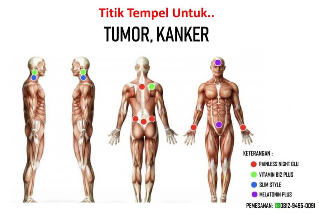 Titik Tempel Koyo One More Untuk Tumor dan Kanker One MOre International